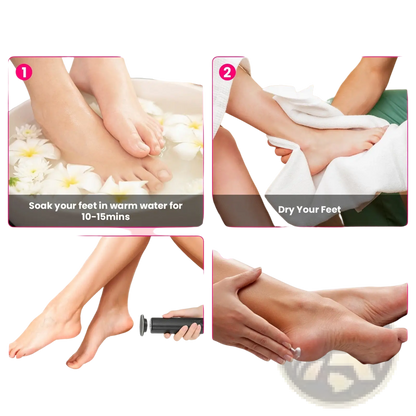 Electric Foot Callus Remover and Nail Grinder Kit