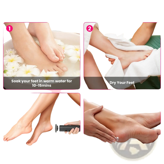 Electric Foot Callus Remover and Nail Grinder Kit